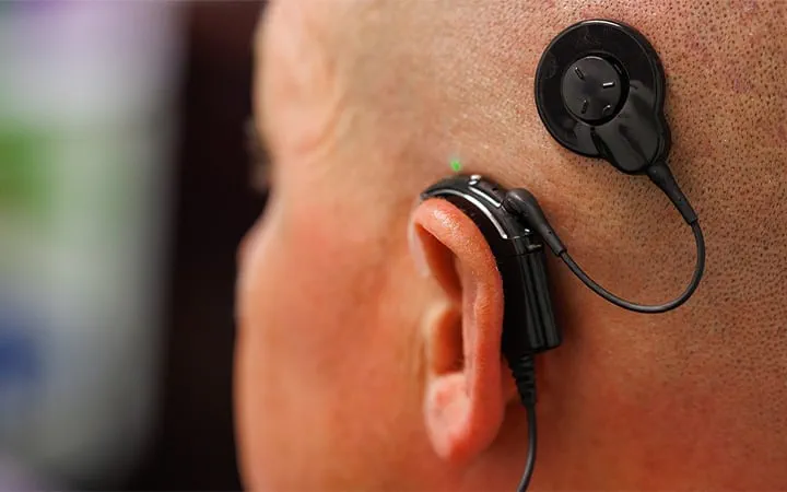 Cochlear Implant