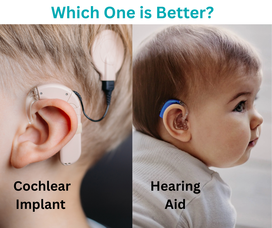 Hearing Aid or Cochlear Implant: Which Does My Child Need, and How Does Therapy Differ for Each?